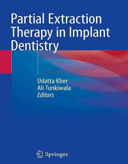 Partial Extraction Therapy in Implant Dentistry 1st Ed 2020